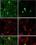 Rabbit IgG (H+L) Highly Cross-Adsorbed Secondary Antibody in Immunohistochemistry (IHC)