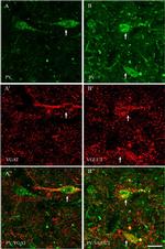 Rabbit IgG (H+L) Highly Cross-Adsorbed Secondary Antibody in Immunohistochemistry (IHC)