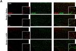 Mouse IgG (H+L) Highly Cross-Adsorbed Secondary Antibody in Immunohistochemistry (IHC)