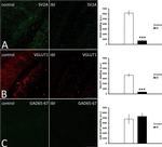 Mouse IgG (H+L) Highly Cross-Adsorbed Secondary Antibody in Immunohistochemistry (PFA fixed) (IHC (PFA))