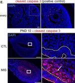 Rabbit IgG (H+L) Highly Cross-Adsorbed Secondary Antibody in Immunohistochemistry (Paraffin) (IHC (P))