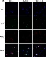 Rabbit IgG (H+L) Highly Cross-Adsorbed Secondary Antibody in Immunocytochemistry (ICC/IF)