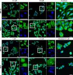 Rabbit IgG (H+L) Highly Cross-Adsorbed Secondary Antibody in Immunocytochemistry (ICC/IF)