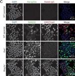 Rabbit IgG (H+L) Highly Cross-Adsorbed Secondary Antibody in Immunocytochemistry (ICC/IF)