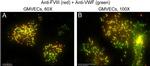 Mouse IgG (H+L) Cross-Adsorbed Secondary Antibody in Immunocytochemistry (ICC/IF)