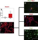 Mouse IgG (H+L) Highly Cross-Adsorbed Secondary Antibody in Immunocytochemistry (ICC/IF)