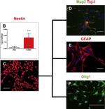 Rabbit IgG (H+L) Cross-Adsorbed Secondary Antibody in Immunocytochemistry (ICC/IF)