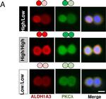 Rabbit IgG (H+L) Highly Cross-Adsorbed Secondary Antibody in Immunocytochemistry (ICC/IF)