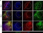 Rat IgG (H+L) Cross-Adsorbed Secondary Antibody in Immunohistochemistry (IHC)