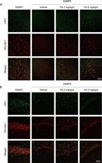 Rabbit IgG (H+L) Cross-Adsorbed Secondary Antibody in Immunohistochemistry (Paraffin) (IHC (P))