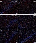 Rabbit IgG (H+L) Highly Cross-Adsorbed Secondary Antibody in Immunohistochemistry (IHC)