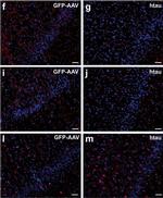 Rabbit IgG (H+L) Highly Cross-Adsorbed Secondary Antibody in Immunohistochemistry (IHC)