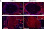 Rabbit IgG (H+L) Highly Cross-Adsorbed Secondary Antibody in Immunohistochemistry (IHC)