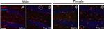 Rabbit IgG (H+L) Highly Cross-Adsorbed Secondary Antibody in Immunohistochemistry (PFA fixed) (IHC (PFA))