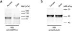 Rabbit IgG (H+L) Cross-Adsorbed Secondary Antibody in Western Blot (WB)