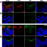 Mouse IgG (H+L) Secondary Antibody in Immunohistochemistry (IHC)