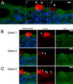 Mouse IgG (H+L) Secondary Antibody in Immunohistochemistry (IHC)