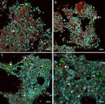 Mouse IgG (H+L) Highly Cross-Adsorbed Secondary Antibody in Immunocytochemistry (ICC/IF)