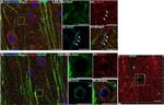 Mouse IgG (H+L) Highly Cross-Adsorbed Secondary Antibody in Immunohistochemistry (IHC)