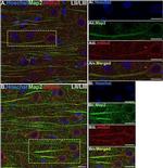 Mouse IgG (H+L) Highly Cross-Adsorbed Secondary Antibody in Immunohistochemistry (IHC)