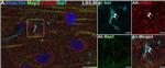 Mouse IgG (H+L) Highly Cross-Adsorbed Secondary Antibody in Immunohistochemistry (IHC)