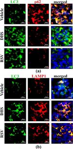 Mouse IgG (H+L) Highly Cross-Adsorbed Secondary Antibody in Immunohistochemistry (IHC)