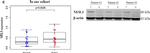 Rabbit IgG (H+L) Highly Cross-Adsorbed Secondary Antibody in Western Blot (WB)