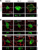 Rabbit IgG (H+L) Highly Cross-Adsorbed Secondary Antibody in Immunohistochemistry (Paraffin) (IHC (P))