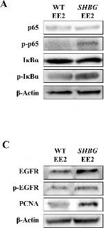 Mouse IgG (H+L) Secondary Antibody in Western Blot (WB)