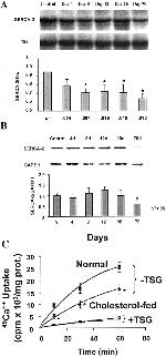 SERCA2 ATPase Antibody in Western Blot (WB)