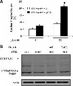 TXNIP Antibody in Western Blot (WB)