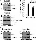 Calcium Sensing Receptor Antibody in Western Blot (WB)