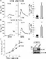 Calcium Sensing Receptor Antibody in Western Blot (WB)