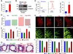 Calcium Sensing Receptor Antibody in Western Blot (WB)