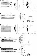 BMPR2 Antibody in Western Blot (WB)