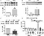 Phospho-CaMKII alpha (Thr286) Antibody in Western Blot (WB)