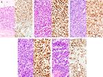 DUX4 Antibody in Immunohistochemistry (IHC)