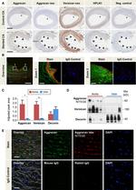 Aggrecan Neo Antibody in Immunohistochemistry (Paraffin) (IHC (P))