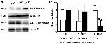 GLUT4 Antibody in Western Blot (WB)