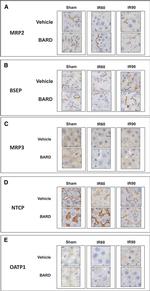 NTCP Antibody in Immunohistochemistry (IHC)