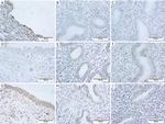 ADORA2B Antibody in Immunohistochemistry (IHC)