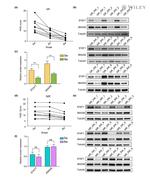 Annexin A6 Antibody in Western Blot (WB)