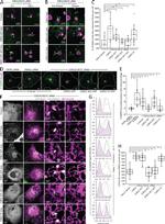 IGF2R Antibody in Immunocytochemistry (ICC/IF)