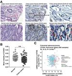 Cyclin D1 Antibody in Immunohistochemistry (IHC)