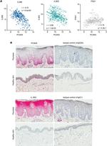 PCSK9 Antibody in Immunohistochemistry (IHC)