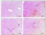 TNF alpha Antibody in Immunohistochemistry (IHC)