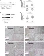 Aconitase 1 Antibody in Western Blot, Immunohistochemistry (WB, IHC)