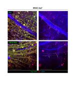 IBA1 Antibody in Immunohistochemistry (IHC)