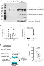 GPSM2 Antibody in Western Blot (WB)