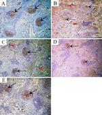 CD20 Antibody in Immunohistochemistry (IHC)